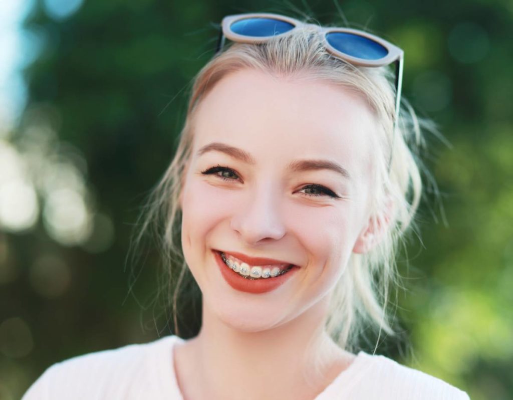 Woman who is an adult with braces for straight teeth.