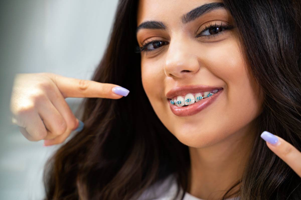 what-are-the-different-types-of-braces-east-highland-dental-office